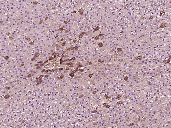 Phosphotyrosine Mouse Monoclonal Antibody