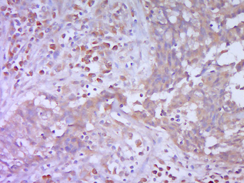 Vimentin Rabbit Polyclonal Antibody