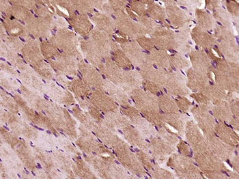 IRS-2 Rabbit Polyclonal Antibody
