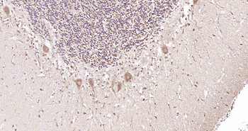 LRCH1 Rabbit Polyclonal Antibody