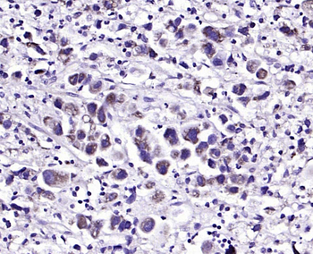 Gremlin Rabbit Polyclonal Antibody