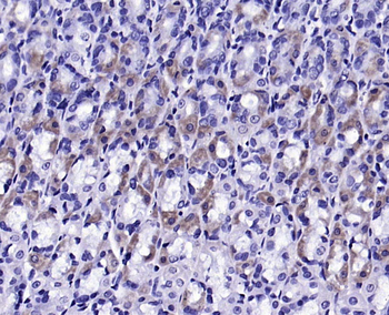 Gremlin Rabbit Polyclonal Antibody