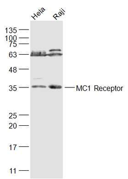 MC1R Rabbit Polyclonal Antibody