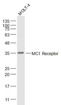 MC1R Rabbit Polyclonal Antibody