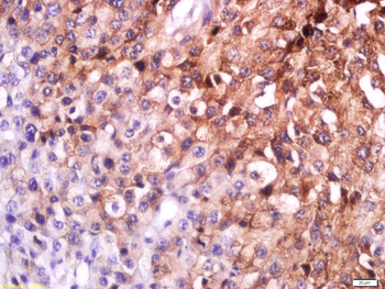 MC1R Rabbit Polyclonal Antibody