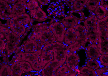 VEGFA Rabbit Polyclonal Antibody