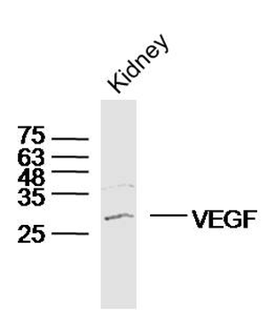 VEGFA Rabbit Polyclonal Antibody