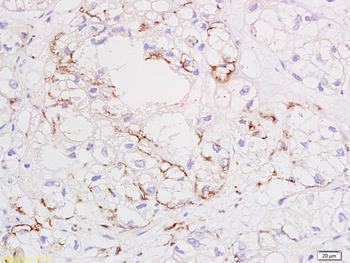 VEGFA Rabbit Polyclonal Antibody