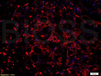 VEGFA Rabbit Polyclonal Antibody
