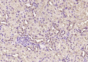 HIF-1 Alpha Rabbit Polyclonal Antibody