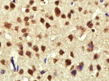 Cyclin D1 Rabbit Polyclonal Antibody