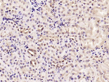 Cyclin D1 Rabbit Polyclonal Antibody
