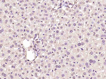 Cyclin D1 Rabbit Polyclonal Antibody