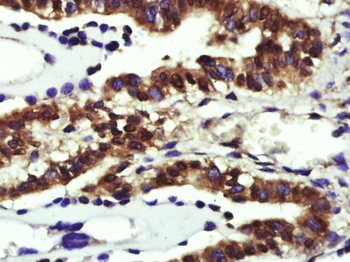 Cyclin D1 Rabbit Polyclonal Antibody