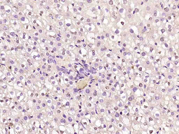 Cyclin D1 Rabbit Polyclonal Antibody