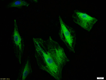 CK18 Rabbit Polyclonal Antibody