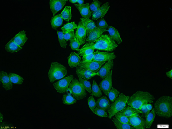 Beta-Actin Rabbit Polyclonal Antibody (Loading Control)