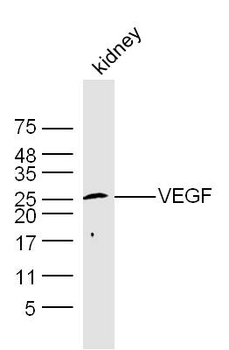 VEGFA Rabbit Polyclonal Antibody
