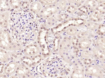 SMAD7 Rabbit Polyclonal Antibody