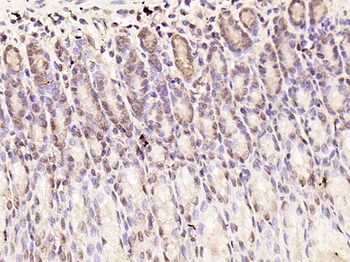 SMAD7 Rabbit Polyclonal Antibody