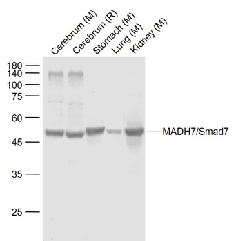 SMAD7 Rabbit Polyclonal Antibody