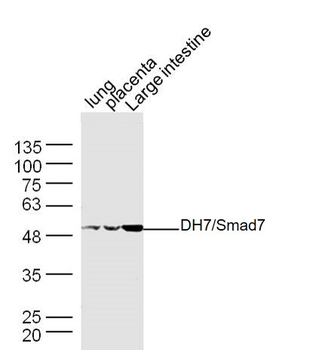 SMAD7 Rabbit Polyclonal Antibody