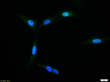 SMAD7 Rabbit Polyclonal Antibody