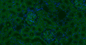 CD34 Rabbit Polyclonal Antibody