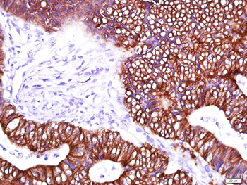 Cytokeratin 8 Mouse Monoclonal Antibody