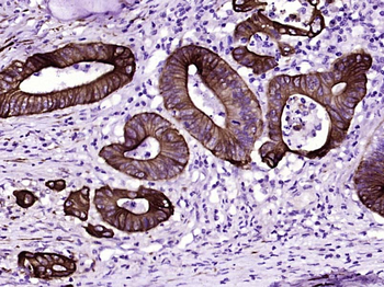 Cytokeratin 8 Mouse Monoclonal Antibody