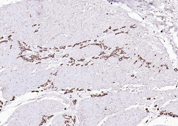 Cytokeratin 8 Mouse Monoclonal Antibody