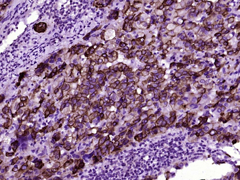 Cytokeratin 8 Mouse Monoclonal Antibody