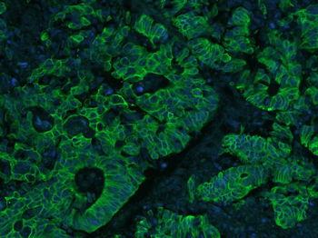 Cytokeratin 8 Mouse Monoclonal Antibody
