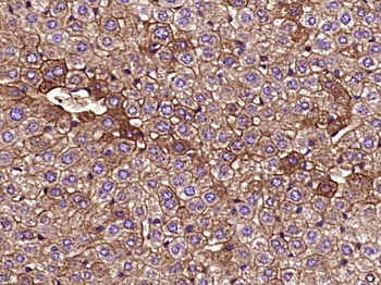 Cytokeratin 8 Mouse Monoclonal Antibody