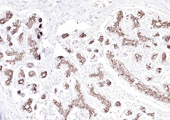 Cytokeratin 8 Mouse Monoclonal Antibody