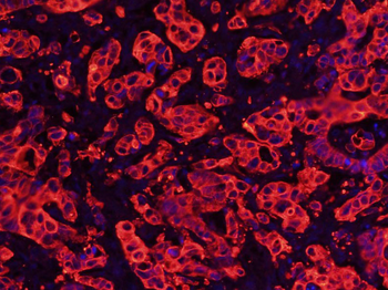 Cytokeratin 8 Mouse Monoclonal Antibody