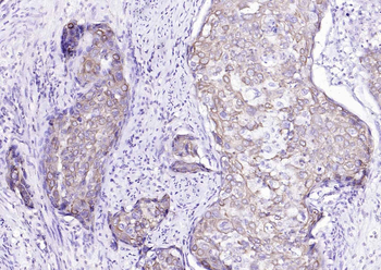 Cytokeratin 8 Mouse Monoclonal Antibody