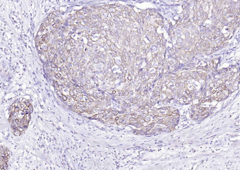 Cytokeratin 8 Mouse Monoclonal Antibody