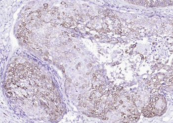 Cytokeratin 8 Mouse Monoclonal Antibody