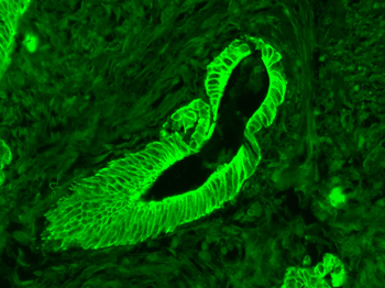 Cytokeratin 8 Mouse Monoclonal Antibody