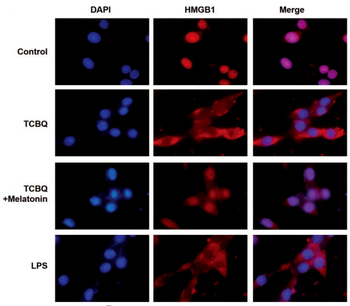 HMGB1 Rabbit Polyclonal Antibody