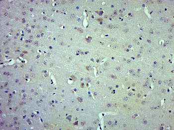 HMGB1 Rabbit Polyclonal Antibody