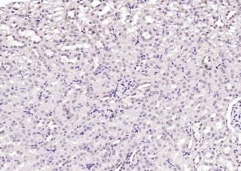 HMGB1 Rabbit Polyclonal Antibody