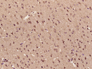 HMGB1 Rabbit Polyclonal Antibody