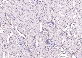 HMGB1 Rabbit Polyclonal Antibody