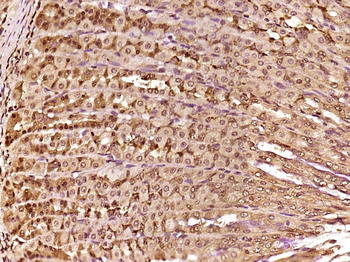 HMGB1 Rabbit Polyclonal Antibody