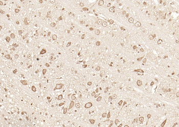 GPR30 Rabbit Polyclonal Antibody