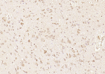 GPR30 Rabbit Polyclonal Antibody