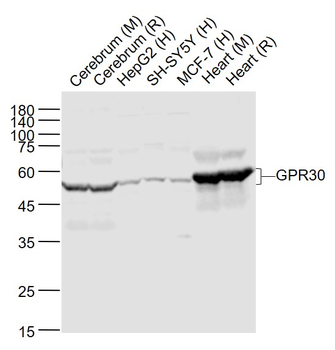 GPR30 Rabbit Polyclonal Antibody