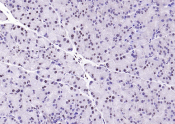 GAPDH Rabbit Polyclonal Antibody (Loading Control)